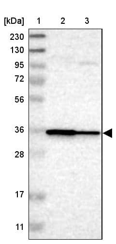 LAX1 Antibody - BSA Free Western Blot: LAX1 Antibody - BSA Free [NBP1-83662]