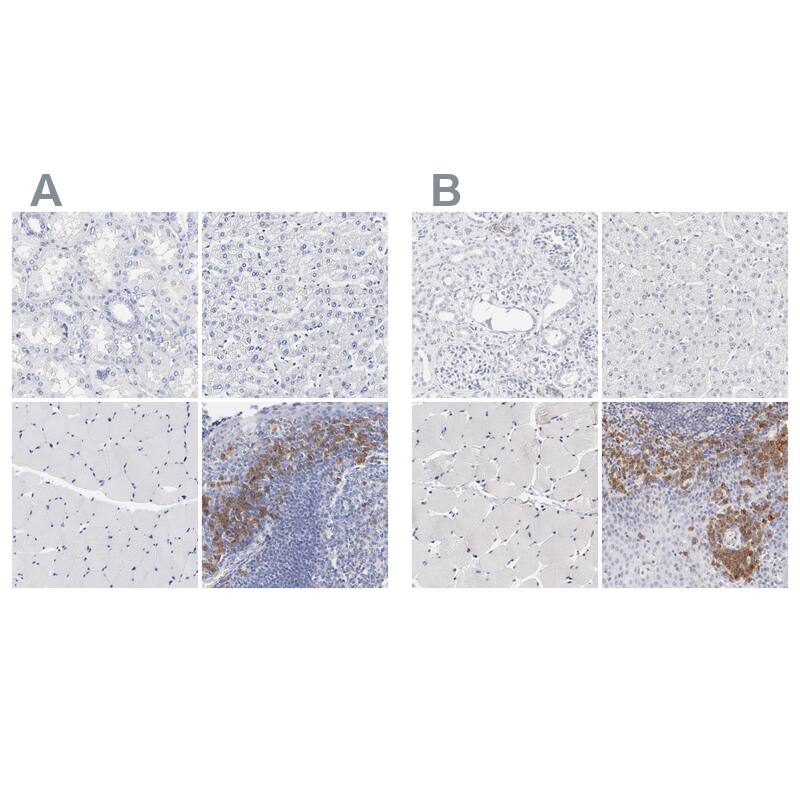 LAX1 Antibody - BSA Free Immunohistochemistry-Paraffin: LAX1 Antibody - BSA Free [NBP1-83662]