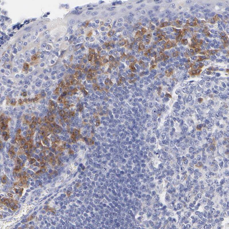 LAX1 Antibody - BSA Free Immunohistochemistry-Paraffin: LAX1 Antibody - BSA Free [NBP1-83662]