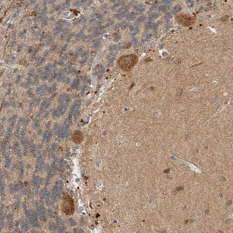PXK Antibody - BSA Free Immunohistochemistry-Paraffin: PXK Antibody - BSA Free [NBP1-83663]