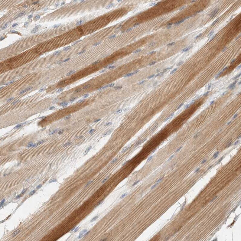 PXK Antibody - BSA Free Immunohistochemistry-Paraffin: PXK Antibody - BSA Free [NBP1-83663]