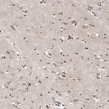 Otubain-1 Antibody - BSA Free Immunohistochemistry-Paraffin: Otubain-1 Antibody - BSA Free [NBP1-83670]