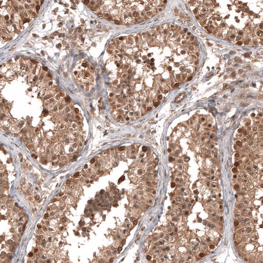 Otubain-1 Antibody - BSA Free Immunohistochemistry-Paraffin: Otubain-1 Antibody - BSA Free [NBP1-83670]