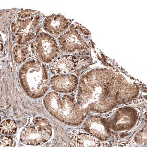 Otubain-1 Antibody - BSA Free Immunohistochemistry-Paraffin: Otubain-1 Antibody - BSA Free [NBP1-83670]