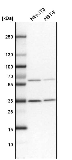 Otubain-1 Antibody - BSA Free Western Blot: Otubain-1 Antibody - BSA Free [NBP1-83670]