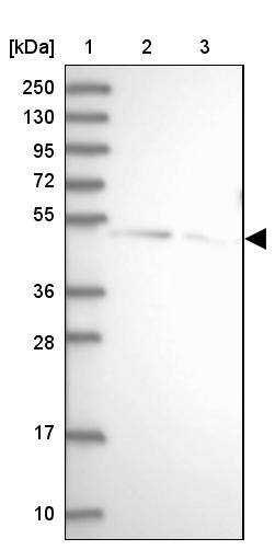 SPRYD3 Antibody - BSA Free Western Blot: SPRYD3 Antibody - BSA Free [NBP1-83681]