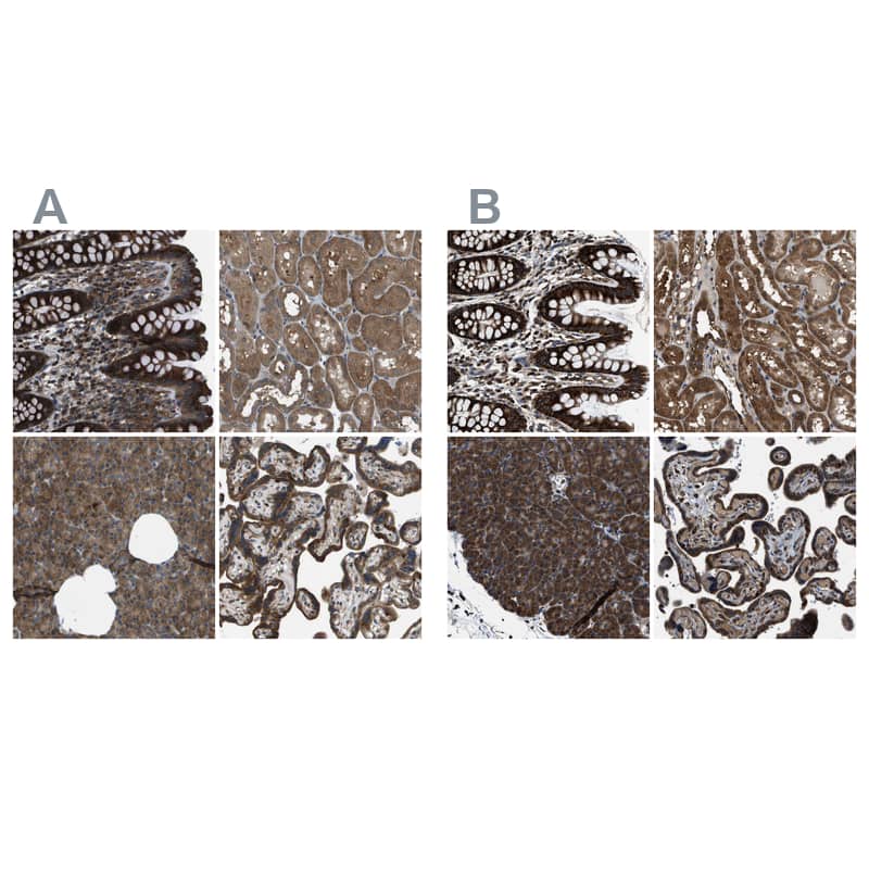 ARFGAP2 Antibody - BSA Free Immunohistochemistry-Paraffin: ARFGAP2 Antibody - BSA Free [NBP1-83687]