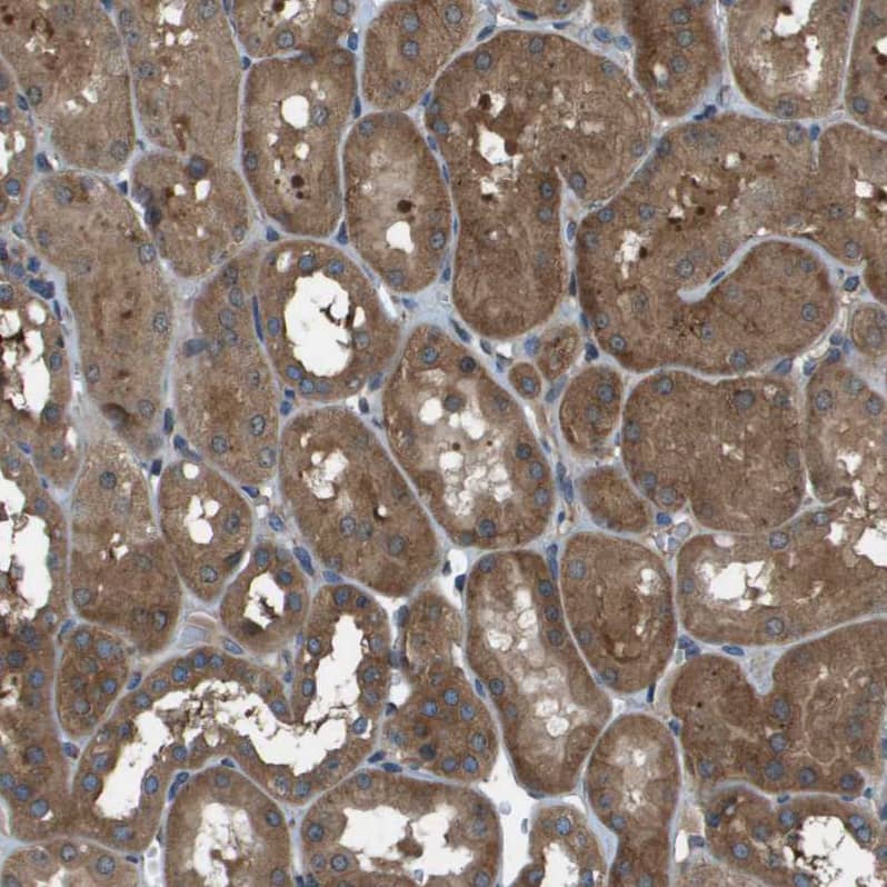 ARFGAP2 Antibody - BSA Free Immunohistochemistry-Paraffin: ARFGAP2 Antibody - BSA Free [NBP1-83687]