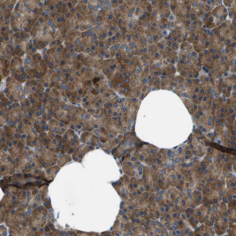 ARFGAP2 Antibody - BSA Free Immunohistochemistry-Paraffin: ARFGAP2 Antibody - BSA Free [NBP1-83687]