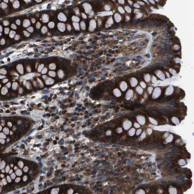 ARFGAP2 Antibody - BSA Free Immunohistochemistry-Paraffin: ARFGAP2 Antibody - BSA Free [NBP1-83687]