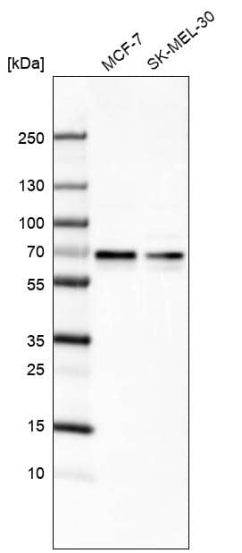 ARFGAP2 Antibody - BSA Free Western Blot: ARFGAP2 Antibody - BSA Free [NBP1-83687]