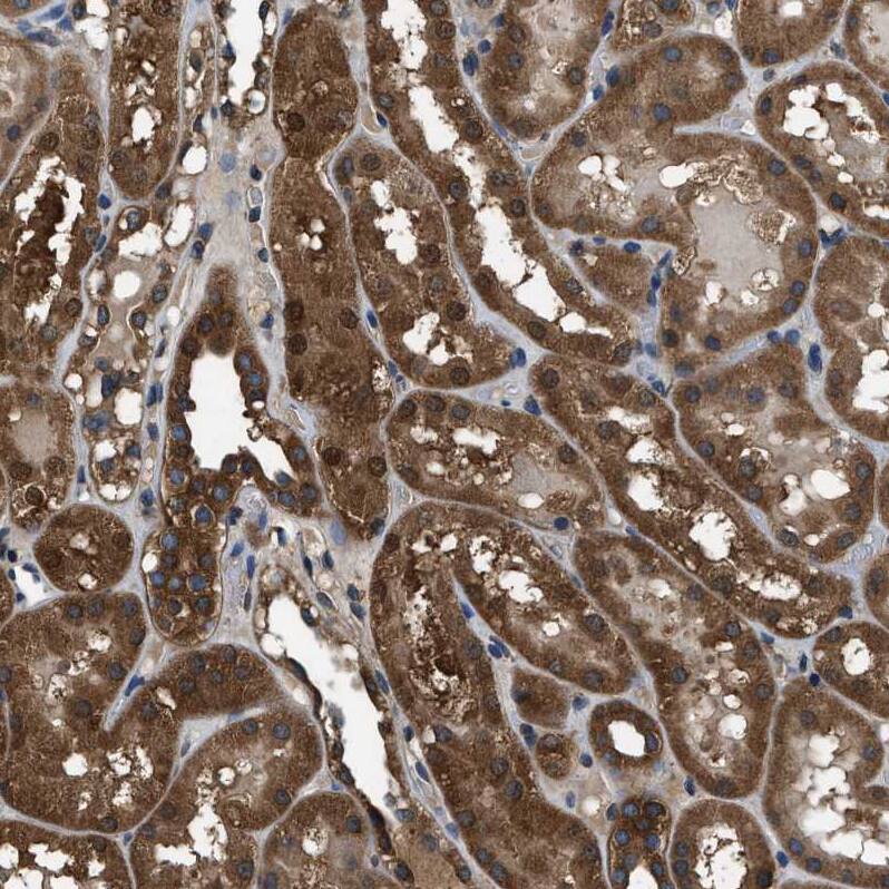 ARFGAP2 Antibody - BSA Free Immunohistochemistry-Paraffin: ARFGAP2 Antibody - BSA Free [NBP1-83688]