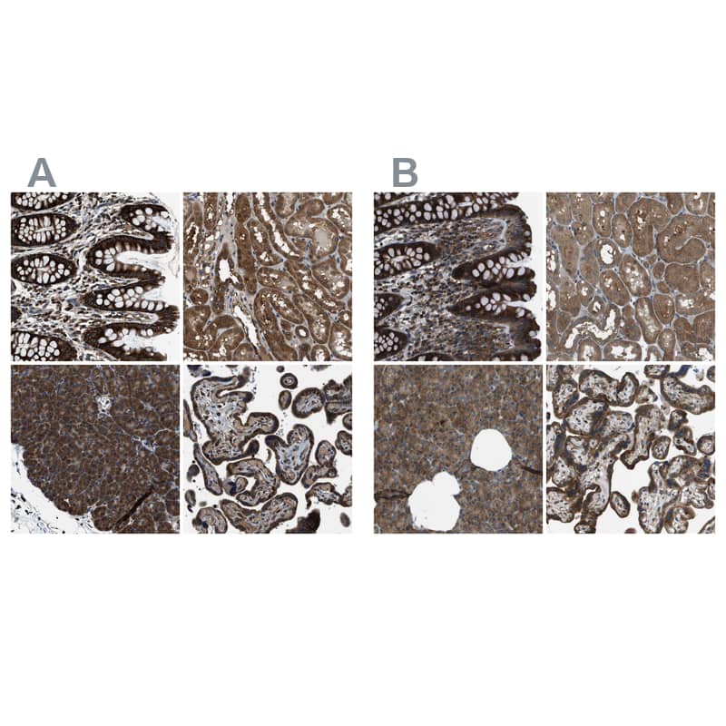 ARFGAP2 Antibody - BSA Free Immunohistochemistry-Paraffin: ARFGAP2 Antibody - BSA Free [NBP1-83688]