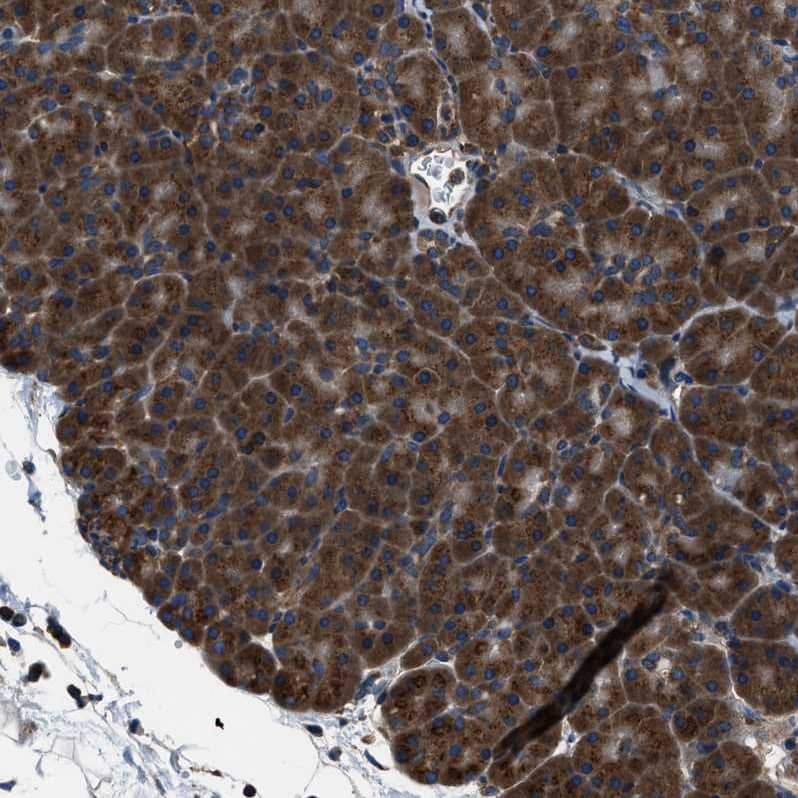 ARFGAP2 Antibody - BSA Free Immunohistochemistry-Paraffin: ARFGAP2 Antibody - BSA Free [NBP1-83688]