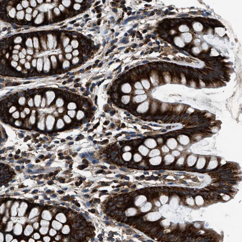 ARFGAP2 Antibody - BSA Free Immunohistochemistry-Paraffin: ARFGAP2 Antibody - BSA Free [NBP1-83688]