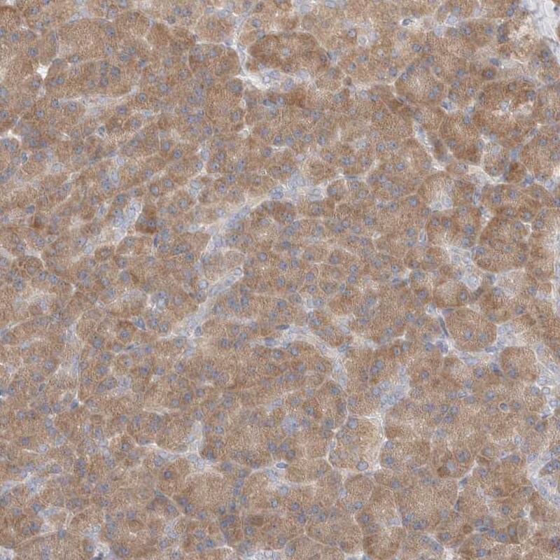 C16orf58 Antibody - BSA Free Immunohistochemistry-Paraffin: C16orf58 Antibody [NBP1-83692]