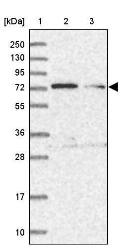 TTC12 Antibody - BSA Free Western Blot: TTC12 Antibody - BSA Free [NBP1-83693]