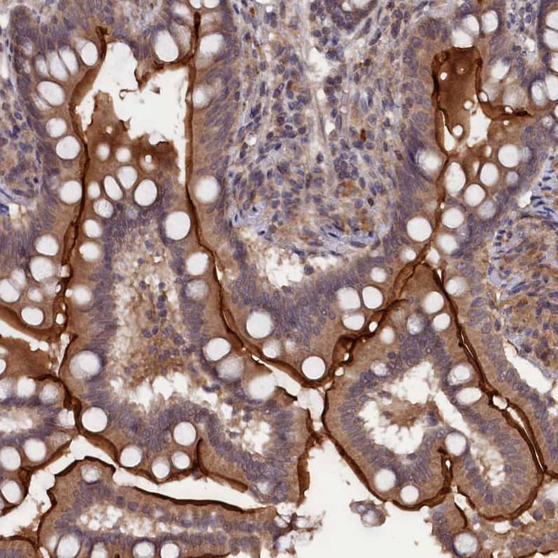 TMC5 Antibody - BSA Free Immunohistochemistry-Paraffin: TMC5 Antibody - BSA Free [NBP1-83697]