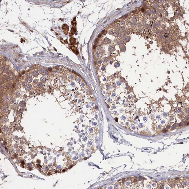 TMC5 Antibody - BSA Free Immunohistochemistry-Paraffin: TMC5 Antibody - BSA Free [NBP1-83697]