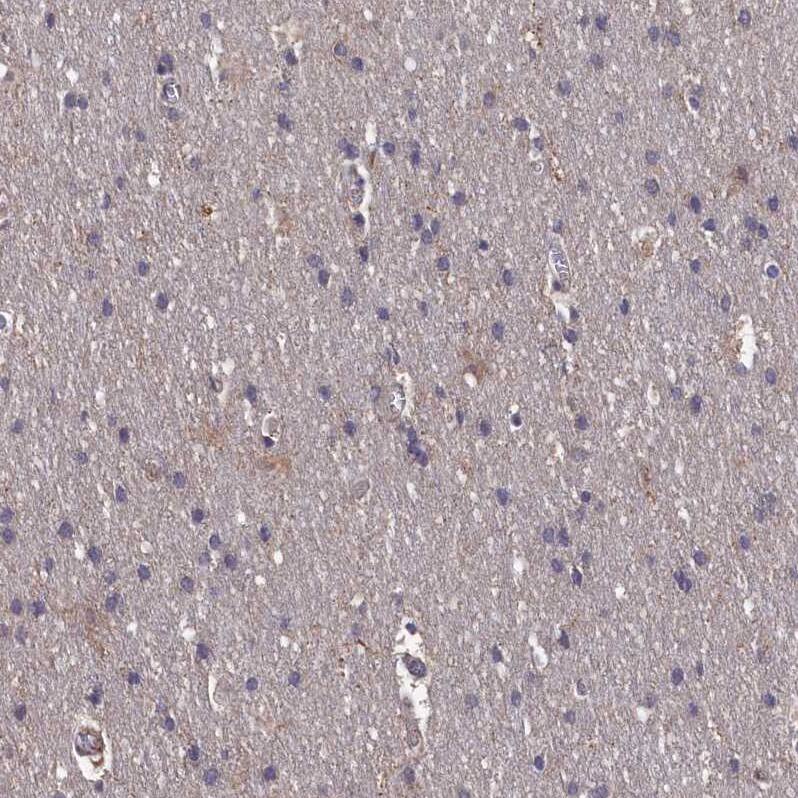 TMC5 Antibody - BSA Free Immunohistochemistry-Paraffin: TMC5 Antibody - BSA Free [NBP1-83697]