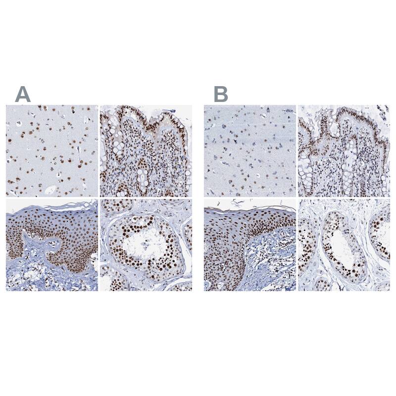 SLTM Antibody - BSA Free Immunohistochemistry-Paraffin: SLTM Antibody - BSA Free [NBP1-83701]