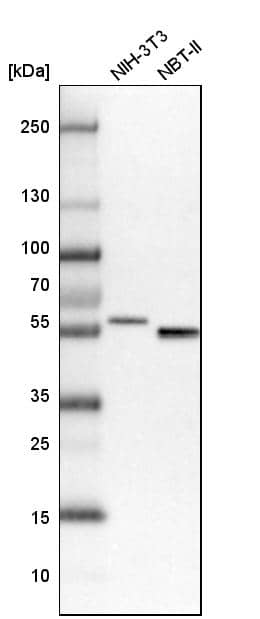 SMAP1 Antibody - BSA Free Western Blot: SMAP1 Antibody - BSA Free [NBP1-83702]