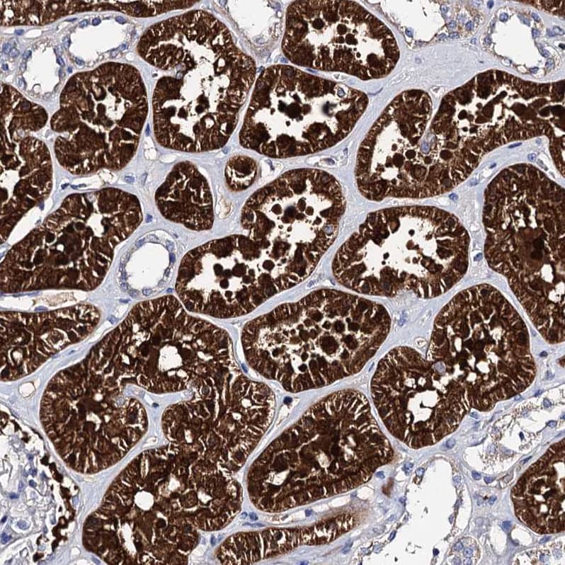 CLPB Antibody - BSA Free Immunohistochemistry-Paraffin: CLPB Antibody - BSA Free [NBP1-83703]