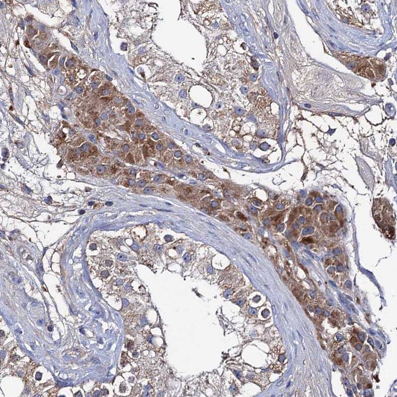 CLPB Antibody - BSA Free Immunohistochemistry-Paraffin: CLPB Antibody - BSA Free [NBP1-83703]