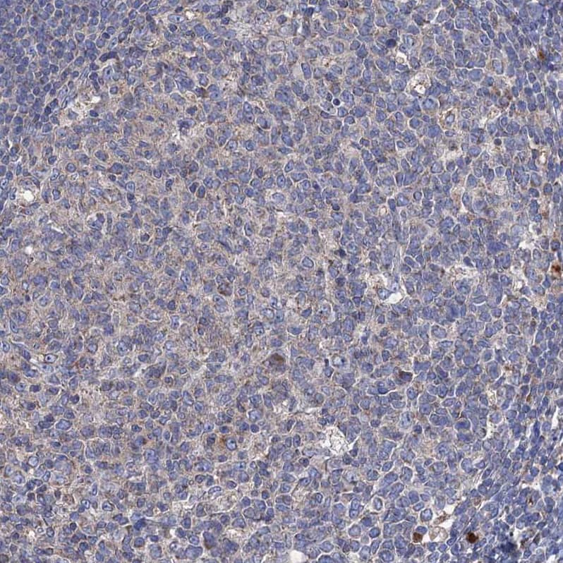 CLPB Antibody - BSA Free Immunohistochemistry-Paraffin: CLPB Antibody - BSA Free [NBP1-83703]