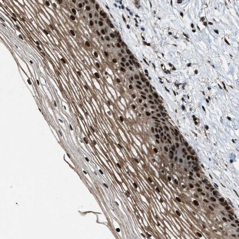 ZBTB10 Antibody - BSA Free Immunohistochemistry-Paraffin: ZBTB10 Antibody - BSA Free [NBP1-83714]