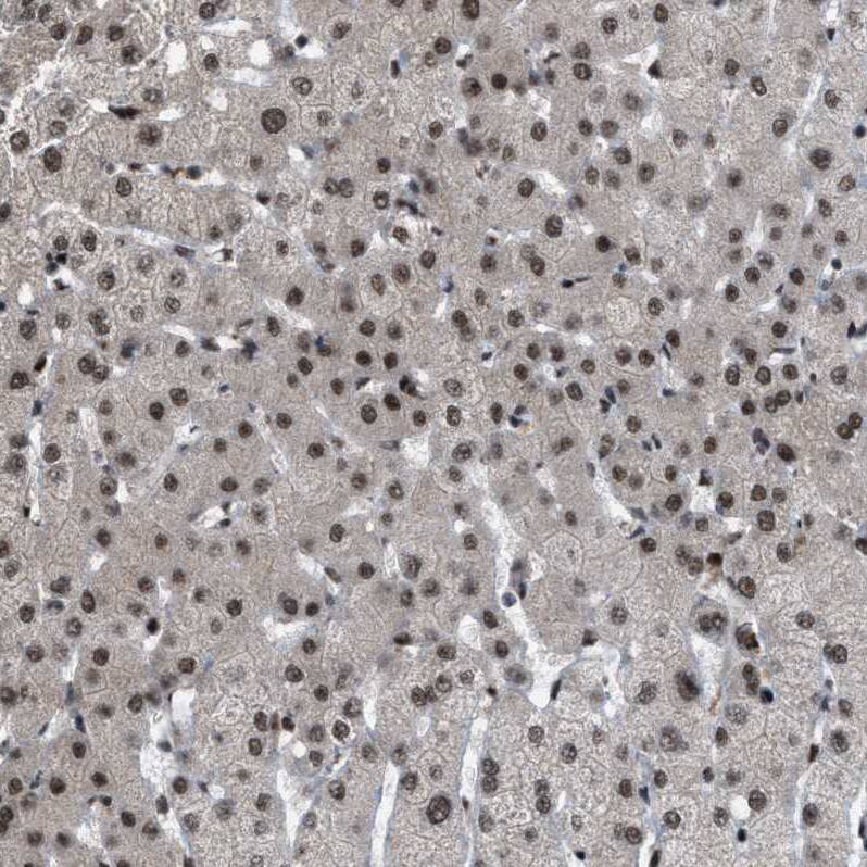 ZBTB10 Antibody - BSA Free Immunohistochemistry-Paraffin: ZBTB10 Antibody - BSA Free [NBP1-83714]