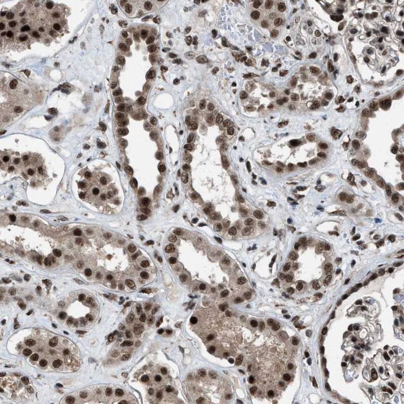 ZBTB10 Antibody - BSA Free Immunohistochemistry-Paraffin: ZBTB10 Antibody - BSA Free [NBP1-83714]