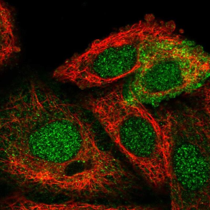 STRA6 Antibody - BSA Free Immunocytochemistry/ Immunofluorescence: STRA6 Antibody [NBP1-83719]