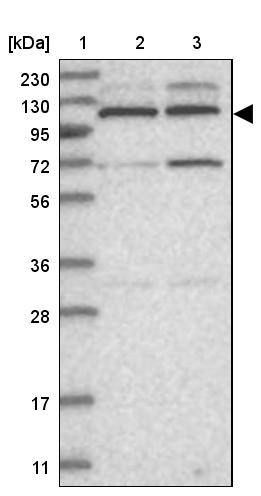 Kif4A Antibody - BSA Free Western Blot: Kif4A Antibody - BSA Free [NBP1-83720]