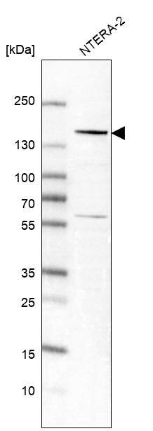 Kif4A Antibody - BSA Free Western Blot: Kif4A Antibody - BSA Free [NBP1-83721]