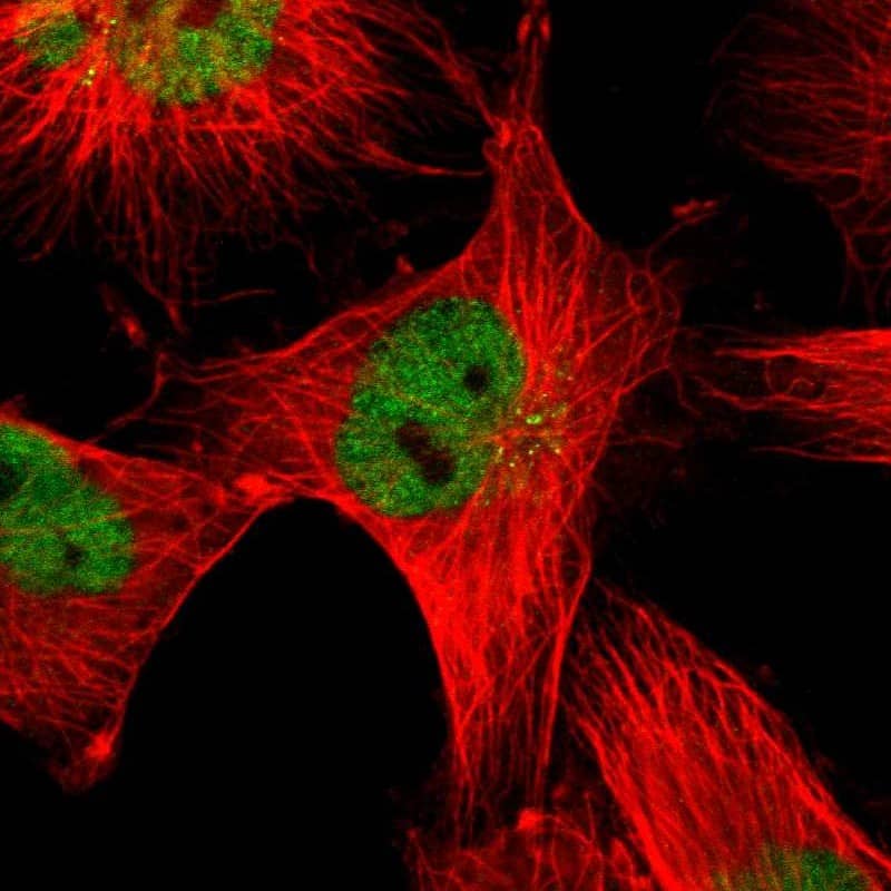 TIF1 gamma Antibody - BSA Free Immunocytochemistry/ Immunofluorescence: TIF1 gamma Antibody - BSA Free [NBP1-83747]
