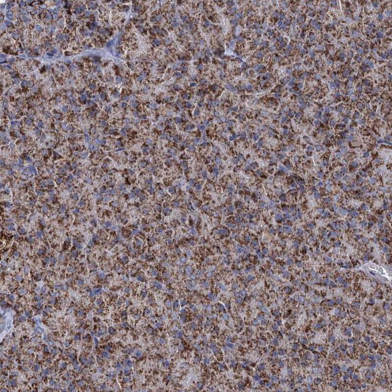 ABHD10 Antibody - BSA Free Immunohistochemistry-Paraffin: ABHD10 Antibody - BSA Free [NBP1-83748]