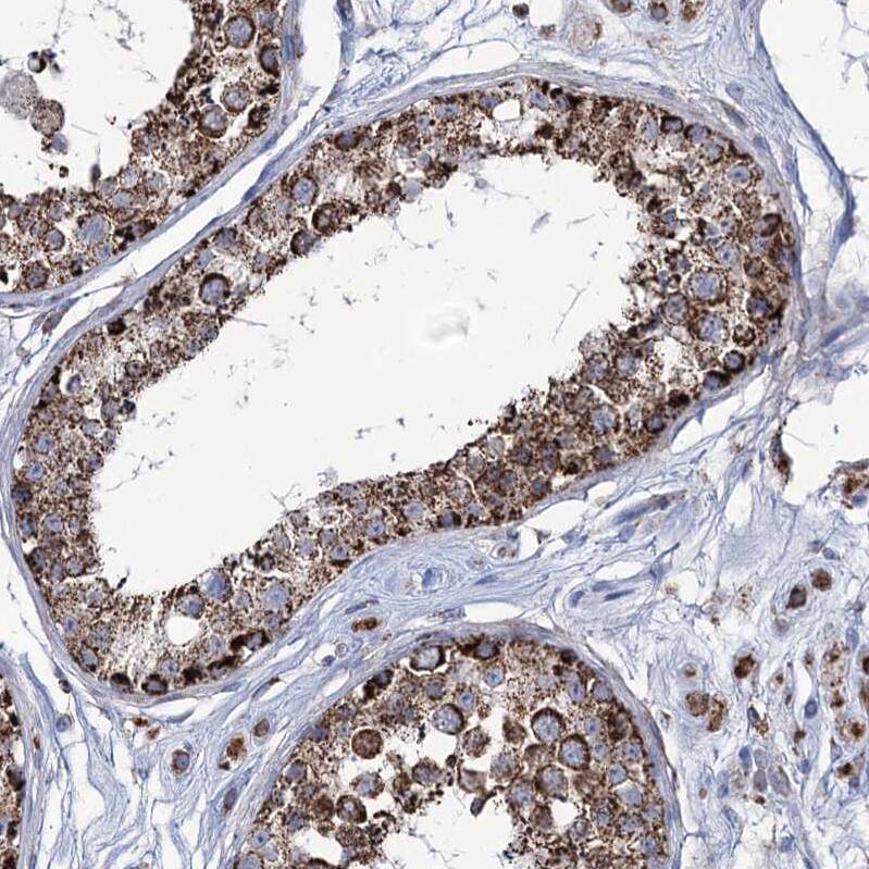 ABHD10 Antibody - BSA Free Immunohistochemistry-Paraffin: ABHD10 Antibody - BSA Free [NBP1-83748]
