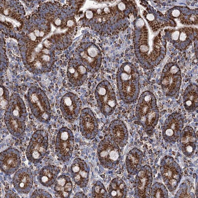 ABHD10 Antibody - BSA Free Immunohistochemistry-Paraffin: ABHD10 Antibody - BSA Free [NBP1-83748]