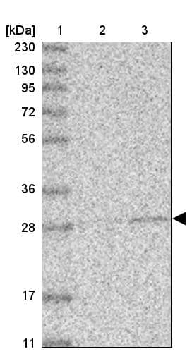 ABHD10 Antibody - BSA Free Western Blot: ABHD10 Antibody - BSA Free [NBP1-83748]