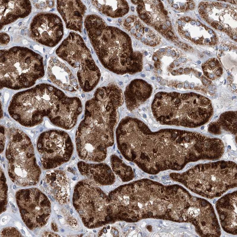 USP48 Antibody - BSA Free Immunohistochemistry-Paraffin: USP48 Antibody - BSA Free [NBP1-83751]