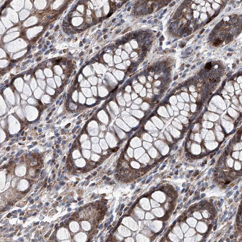 USP48 Antibody - BSA Free Immunohistochemistry-Paraffin: USP48 Antibody - BSA Free [NBP1-83751]
