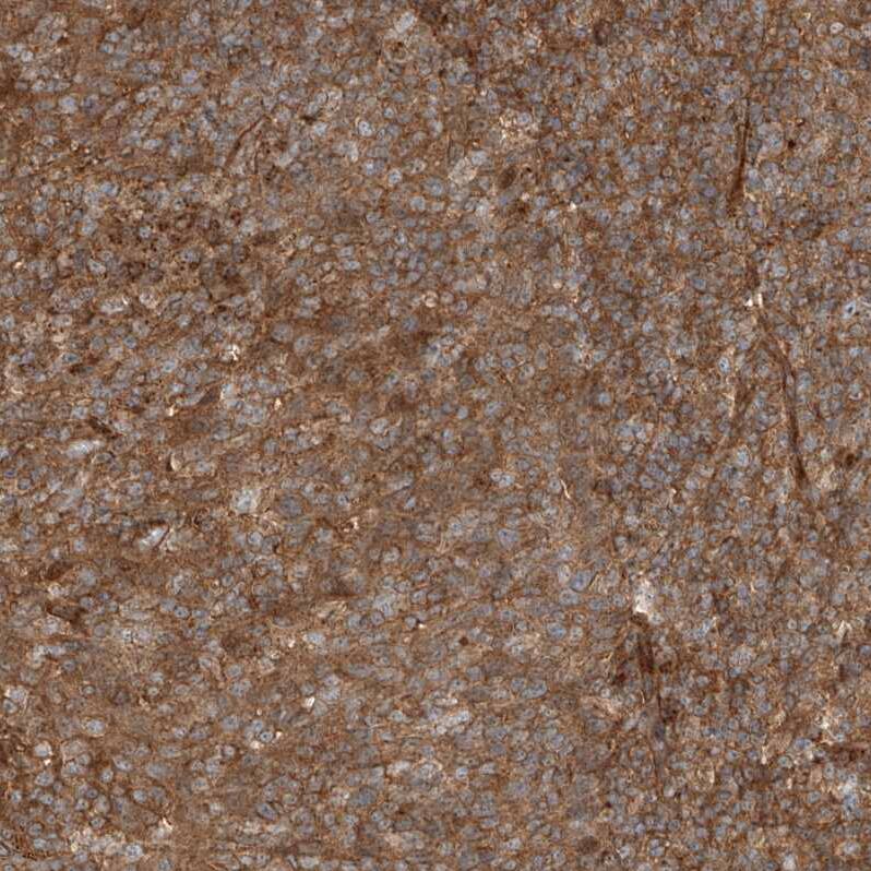 USP48 Antibody - BSA Free Immunohistochemistry-Paraffin: USP48 Antibody - BSA Free [NBP1-83752]