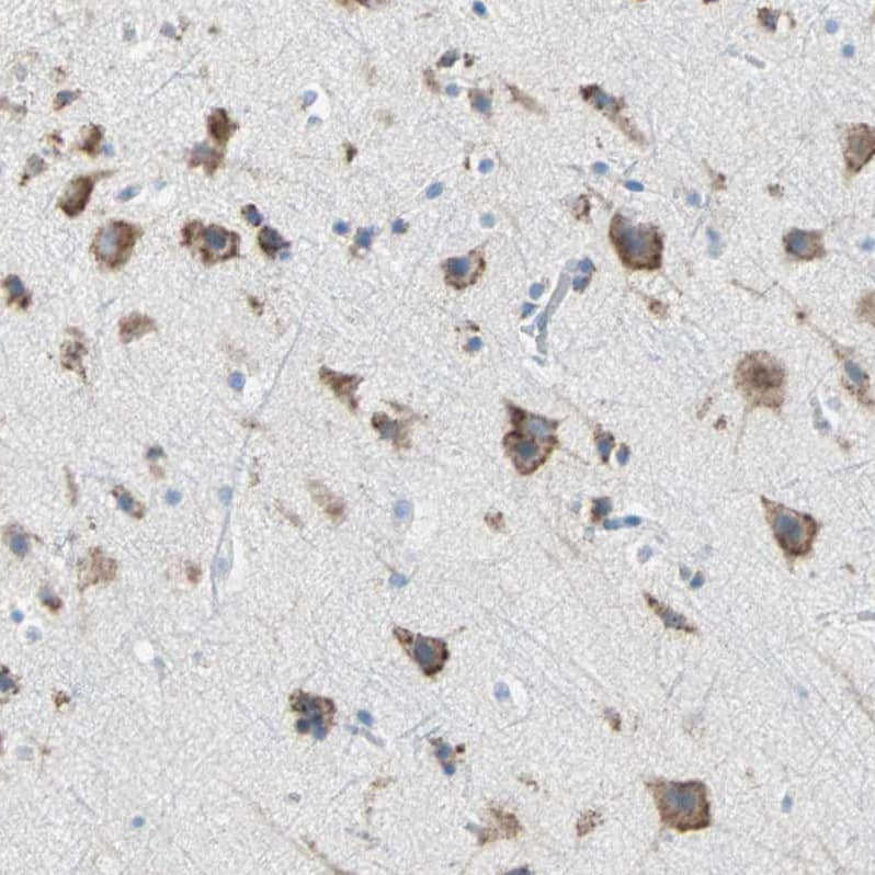PLCXD1 Antibody - BSA Free Immunohistochemistry-Paraffin: PLCXD1 Antibody - BSA Free [NBP1-83753]