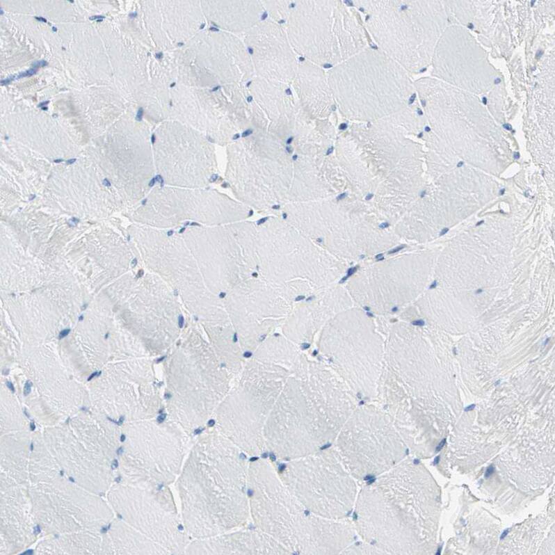 PLCXD1 Antibody - BSA Free Immunohistochemistry-Paraffin: PLCXD1 Antibody - BSA Free [NBP1-83753]