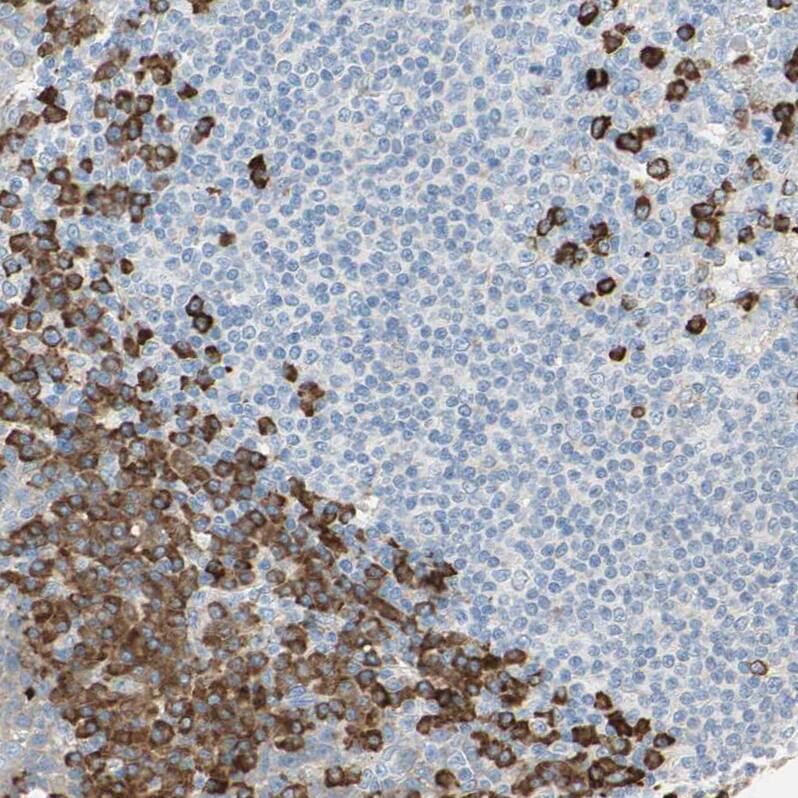 PLCXD1 Antibody - BSA Free Immunohistochemistry-Paraffin: PLCXD1 Antibody - BSA Free [NBP1-83753]