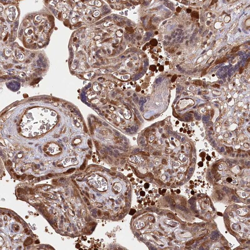 LSG1 Antibody - BSA Free Immunohistochemistry-Paraffin: LSG1 Antibody - BSA Free [NBP1-83755]