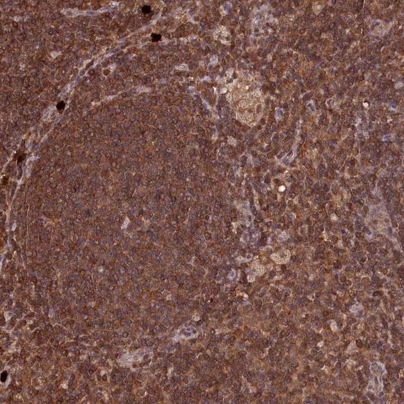 LSG1 Antibody - BSA Free Immunohistochemistry-Paraffin: LSG1 Antibody - BSA Free [NBP1-83755]