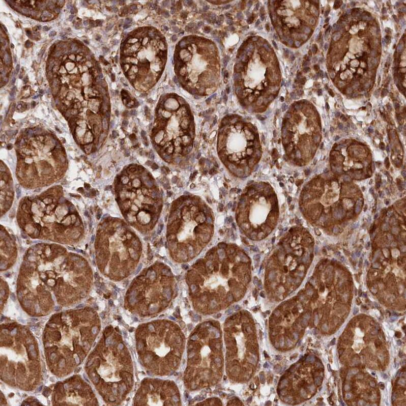 LSG1 Antibody - BSA Free Immunohistochemistry-Paraffin: LSG1 Antibody - BSA Free [NBP1-83755]