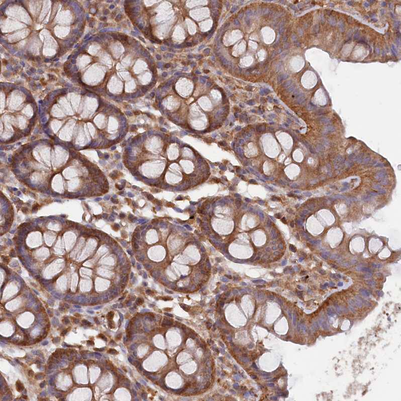 LSG1 Antibody - BSA Free Immunohistochemistry-Paraffin: LSG1 Antibody - BSA Free [NBP1-83755]